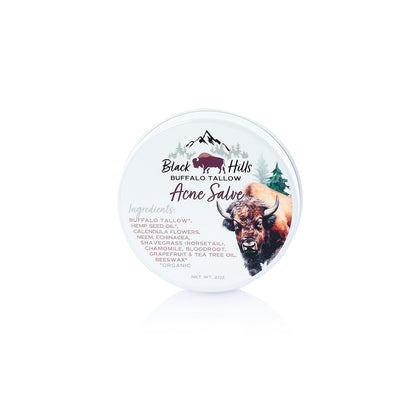 Buffalo Tallow Acne Salve