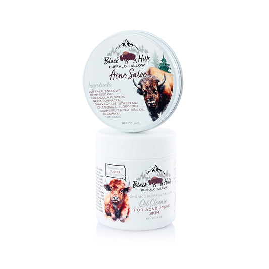 Buffalo Tallow Acne Regimen Bundle